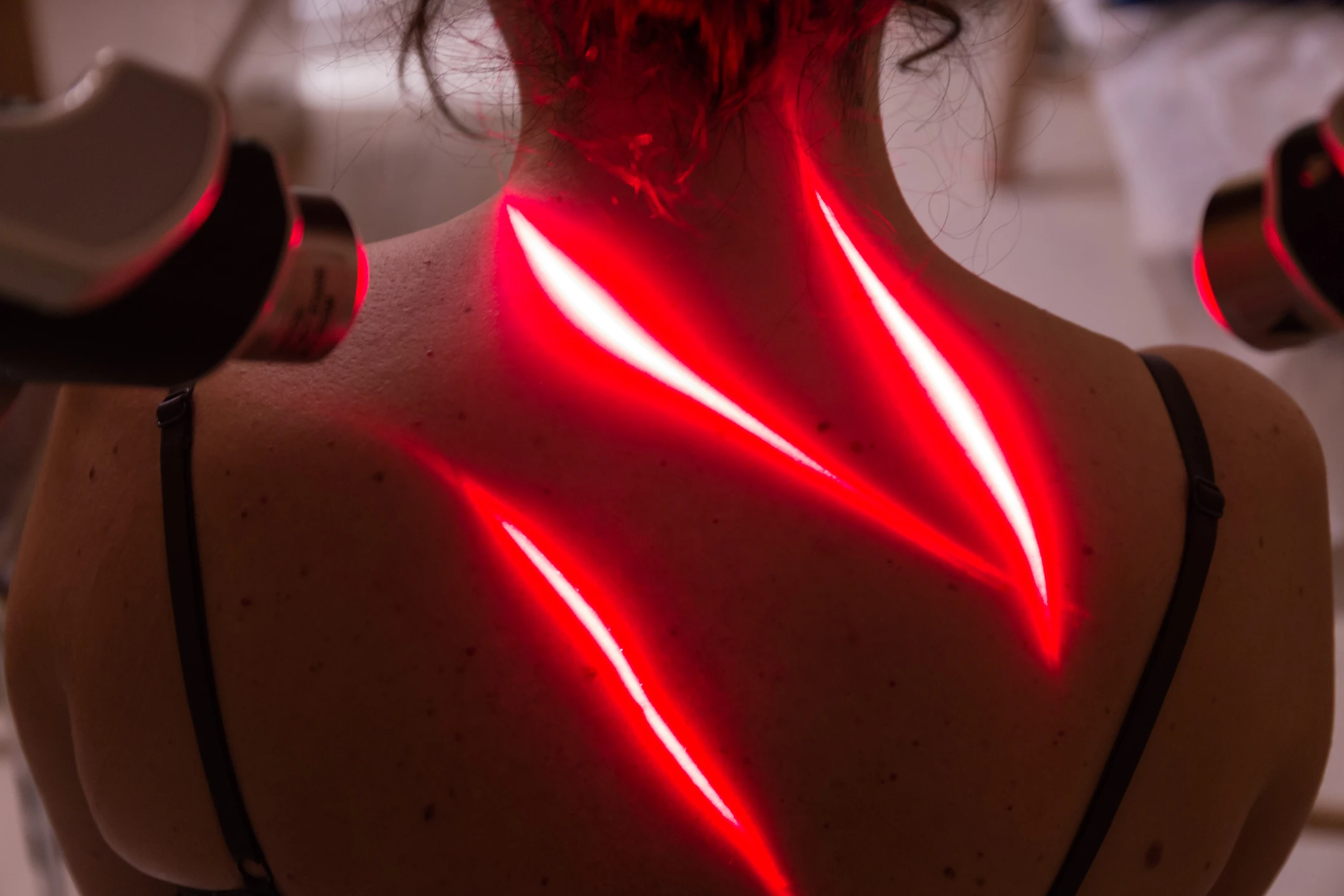 Red laser therapy on person's upper back.